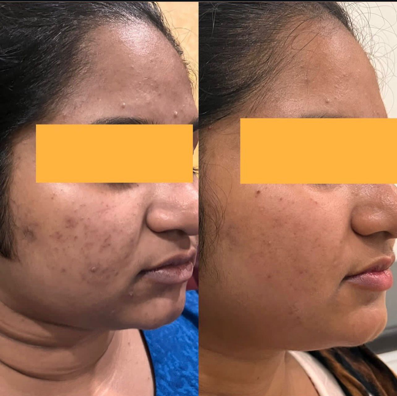 Patient Before and After